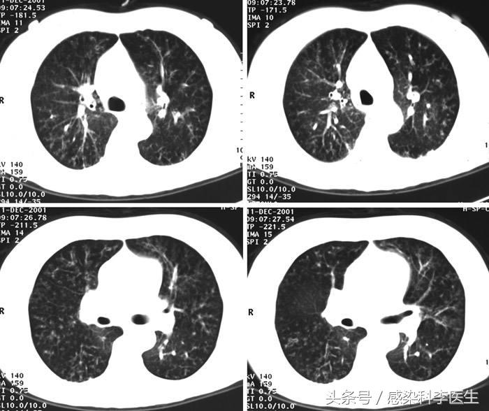 火爆全网!网络棋牌真的可以透视吗!其实确实有挂的